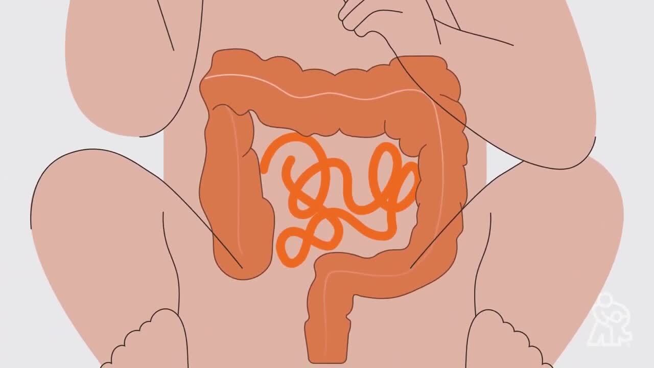 Diagnosing and Treating of Cloacal Anomaly